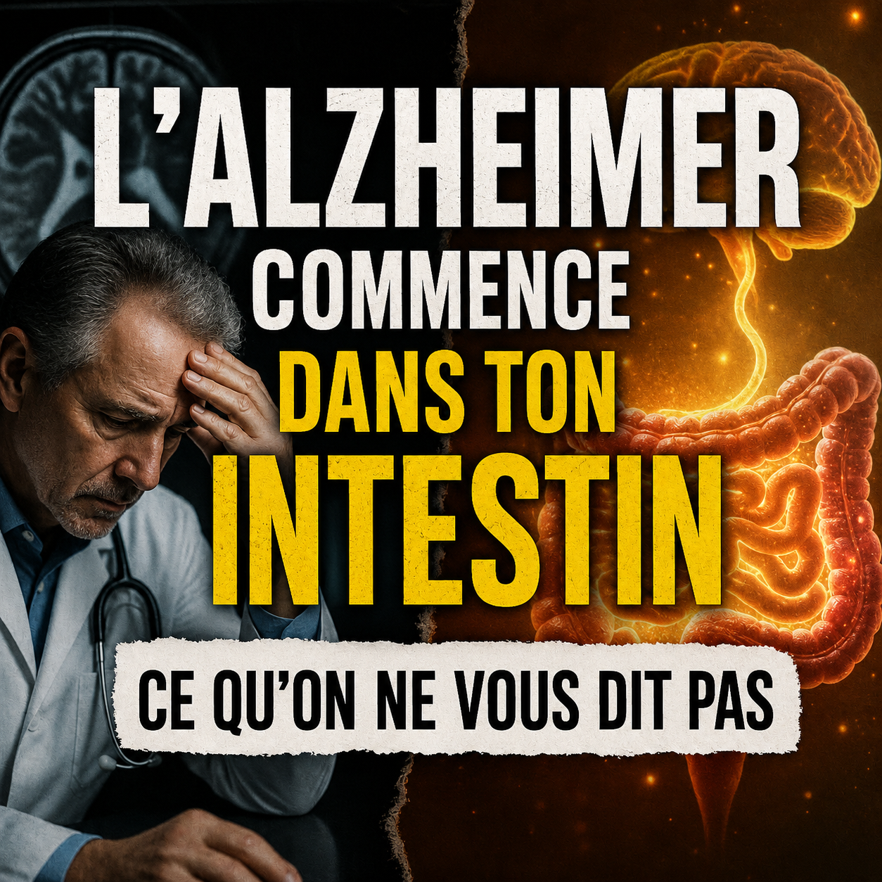 Alzheimer, Nutrition et Microbiote : Comprendre le Terrain pour Mieux Prévenir