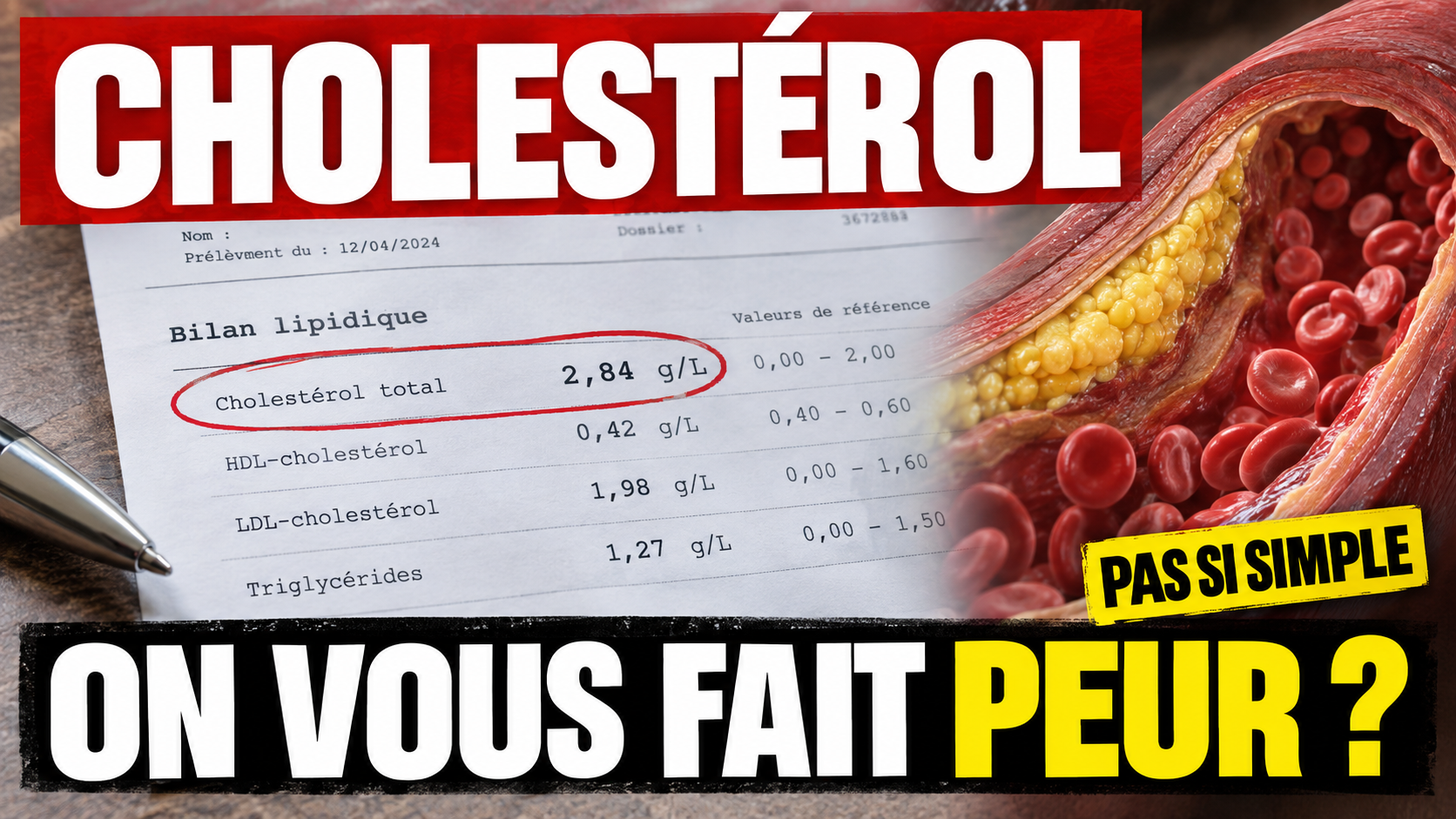 Cholestérol : comprendre le vrai sens derrière les chiffres