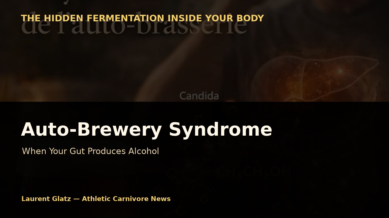 When Your Body Becomes a Still: The Auto-Brewery Syndrome
