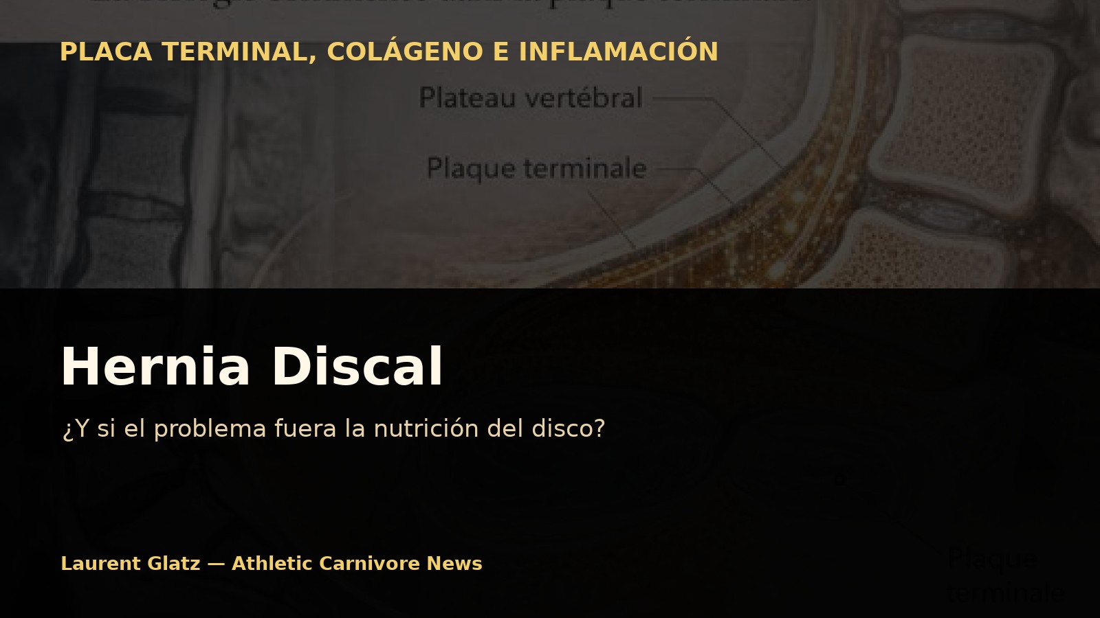 Hernia discal: ¿y si el verdadero problema no fuera el disco, sino lo que lo nutre?