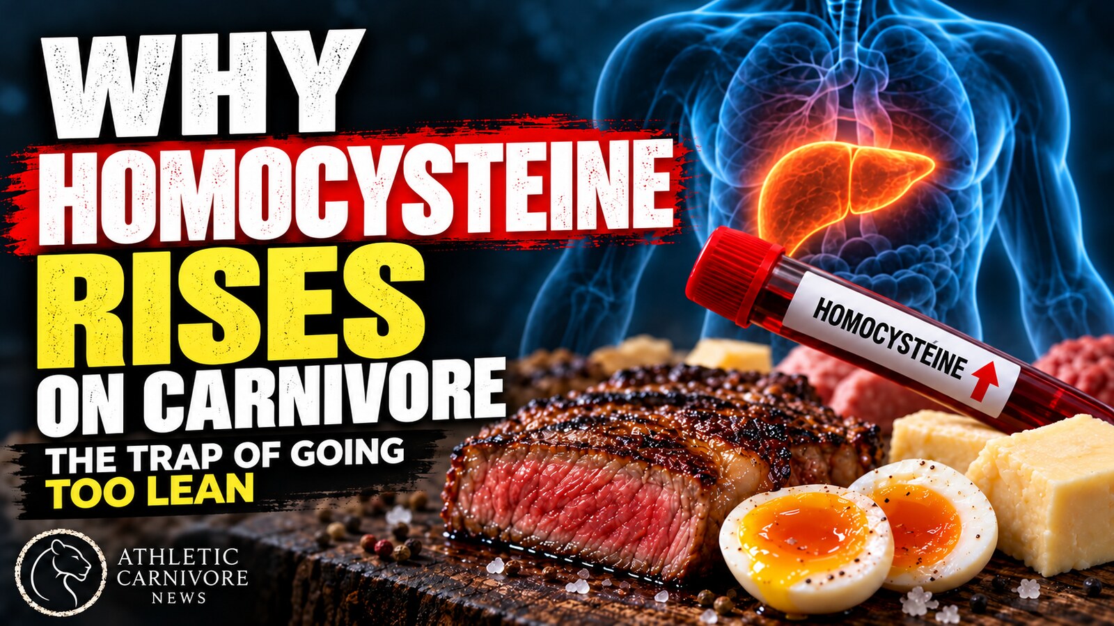 Why Homocysteine Rises on a Lean Carnivore Diet